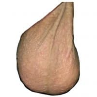 «Scrotum» sticker set